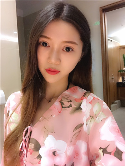 南京艺星汪树杰眼部综合怎么样?好不好?案例分享