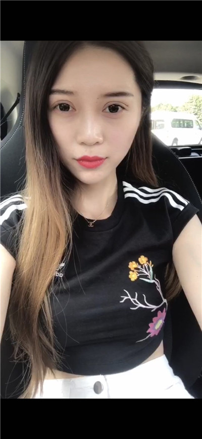 南京艺星汪树杰眼部综合怎么样?好不好?案例分享
