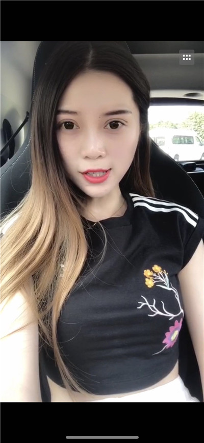 南京艺星汪树杰眼部综合怎么样?好不好?案例分享