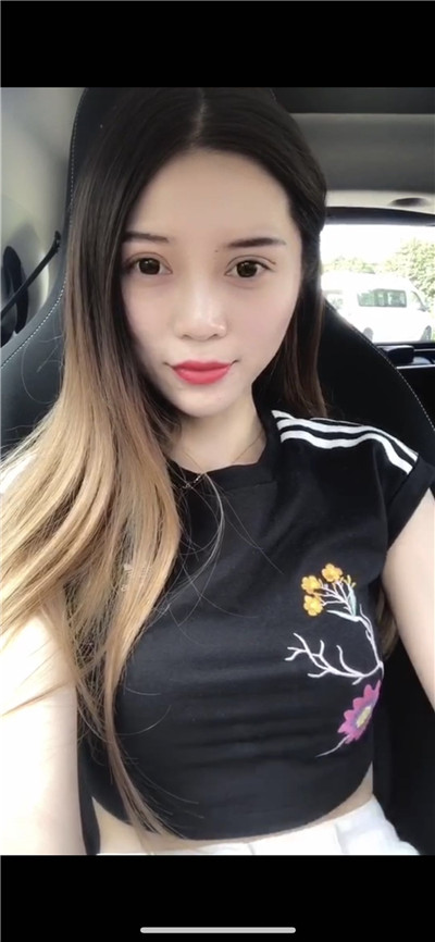 南京艺星汪树杰眼部综合怎么样?好不好?案例分享