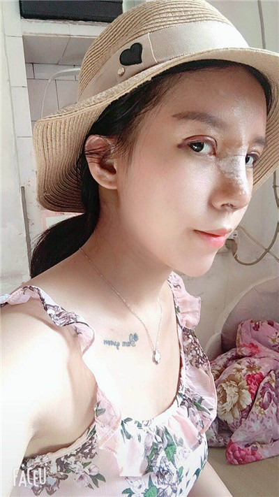 武汉华美马行眼部修复怎么样?好不好?案例分享