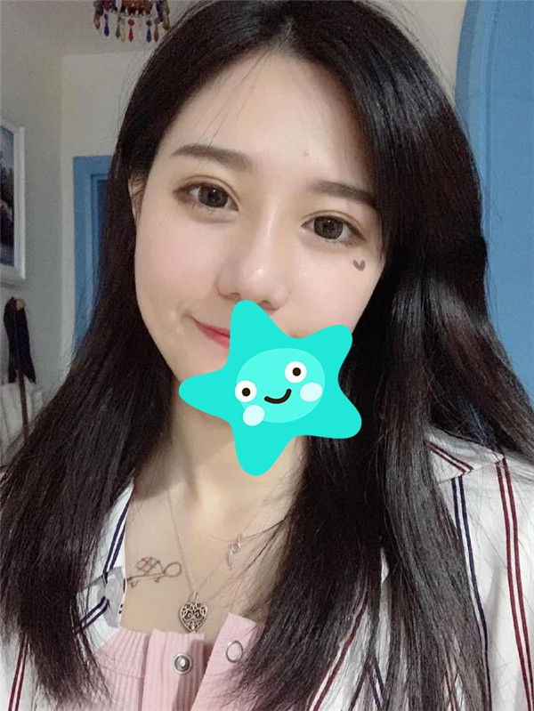 台州博雅美惠整形医院王大明鼻部手术怎么样?价