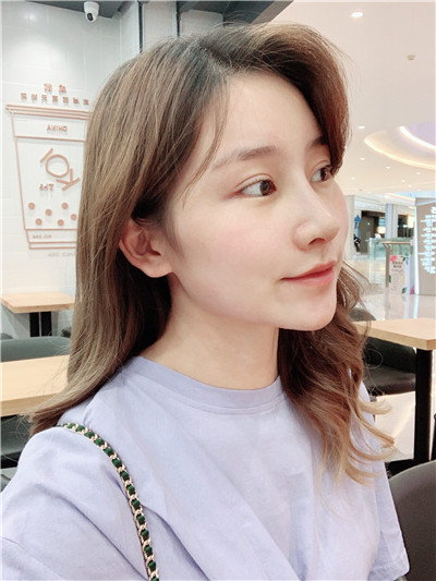四川美莱雷状肋软骨隆鼻怎么样?好不好?案例分享