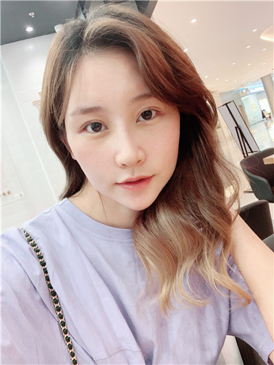 四川美莱雷状肋软骨隆鼻怎么样?好不好?案例分享