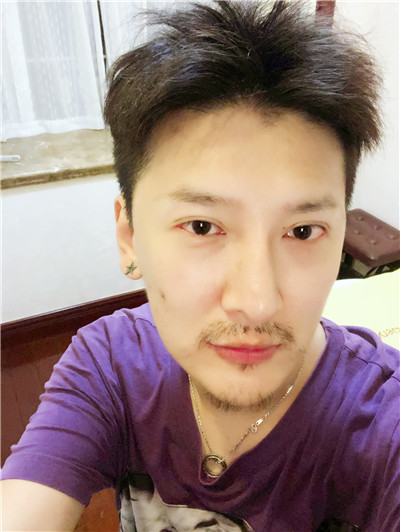 上海艺星童列健M唇手术怎么样?好不好?案例分享