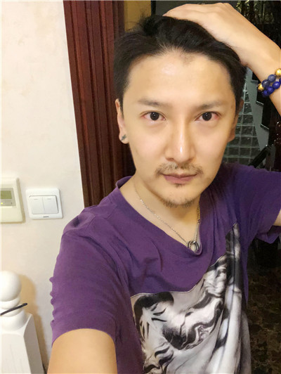 上海艺星童列健M唇手术怎么样?好不好?案例分享