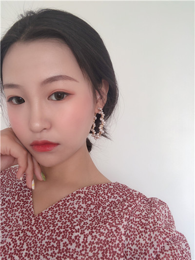 西安高一生张林宏硅胶隆鼻怎么样?好不好?案例分享