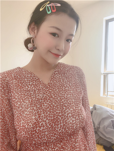 西安高一生张林宏硅胶隆鼻怎么样?好不好?案例分享