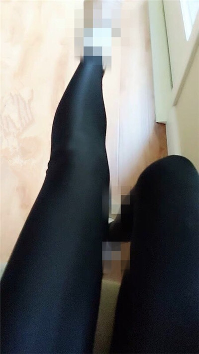 深圳艾妍徐荣阳吸脂怎么样?好不好?案例分享
