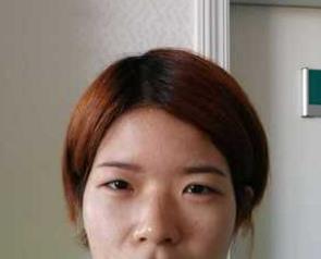 成都格莱丽石峰眼部修复怎么样?好不好?案例分享
