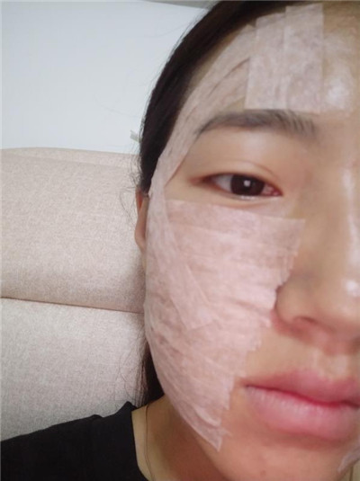 姜兆辉全脸填充怎么样?好不好?案例分享