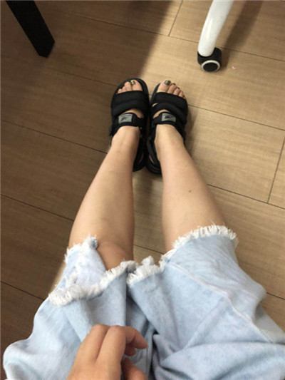 杭州时光刘争瘦小腿怎么样?好不好?案例分享