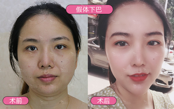 面部改善的顺序是怎么样的?果好不好?
