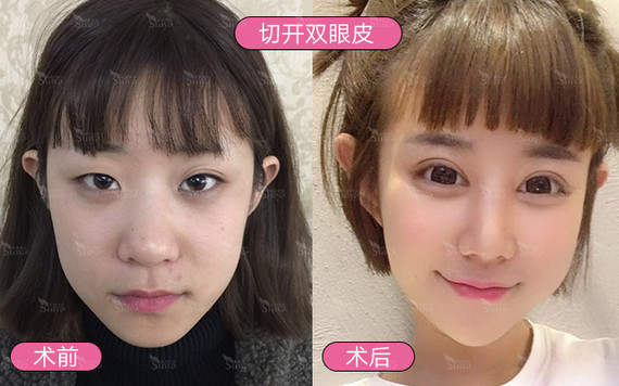 面部改善的顺序是怎么样的?果好不好?