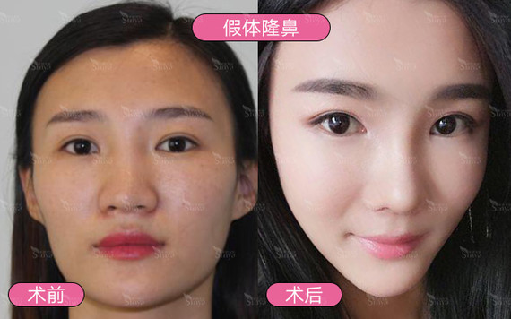 面部改善的顺序是怎么样的?果好不好?