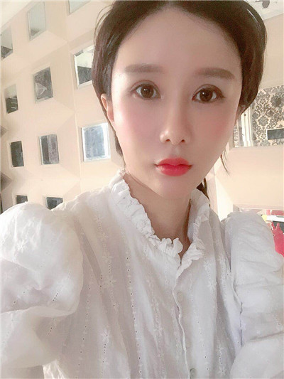 杭州维多利亚马腾面部填充怎么样?好不好?案例分享
