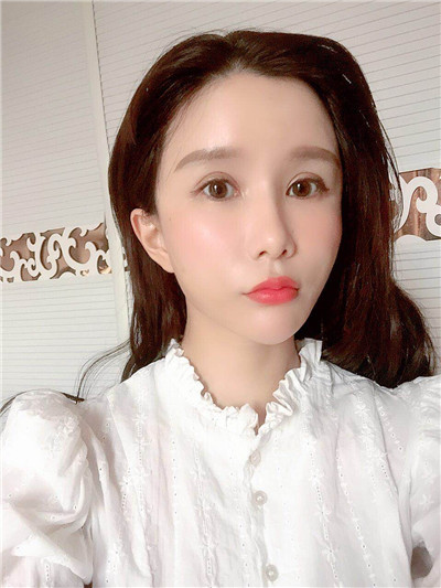 杭州维多利亚马腾面部填充怎么样?好不好?案例分享