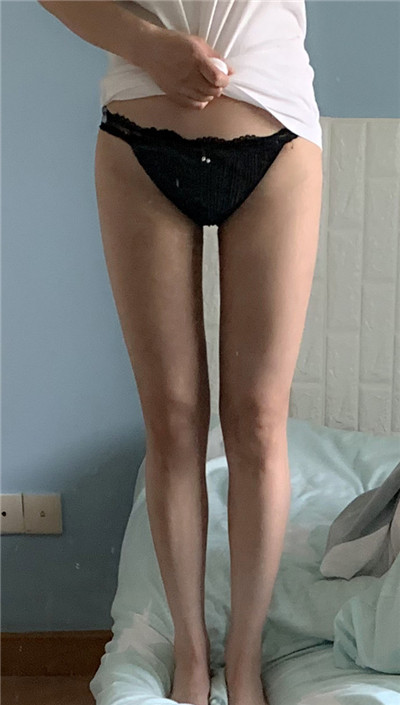 北京金燕子马铁安吸脂瘦大腿怎么样?好不好?案例分享