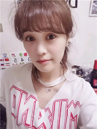 黑龙江超龙吴显宇切开双眼皮怎么样?好不好?案例分享