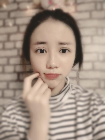 太原美媛荟弓军胜脂肪填充怎么样?价格案例分享