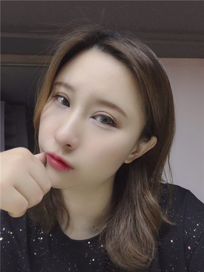 北京百达丽王维内切去眼袋怎么样?价格案例分享