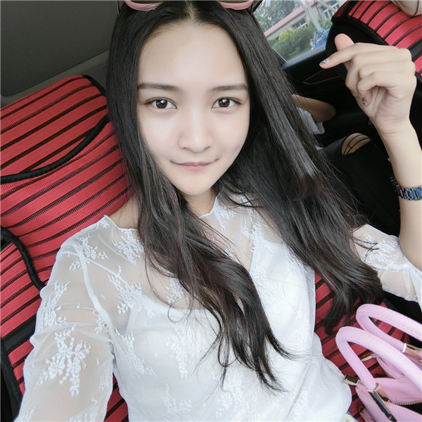 重庆艺星整形医院王长期双眼皮怎么样?价格案