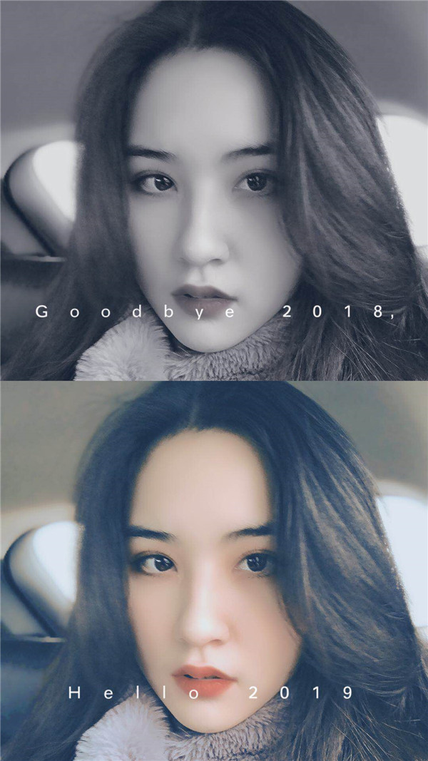 杭州美莱韩超双眼皮怎么样?价格案例.