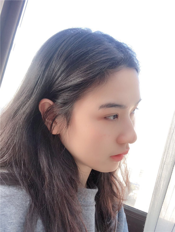 杭州美莱韩超双眼皮怎么样?价格案例.