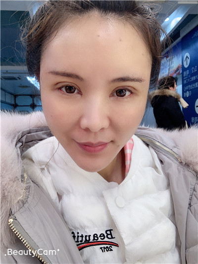 杭州维多利亚刘中策怎么样?价格案例分享