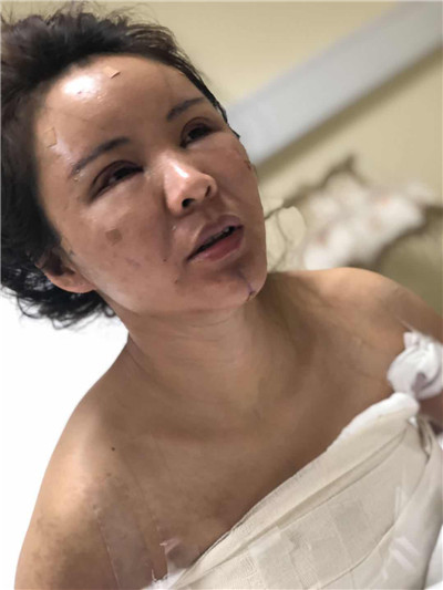 杭州维多利亚刘中策怎么样?价格案例分享