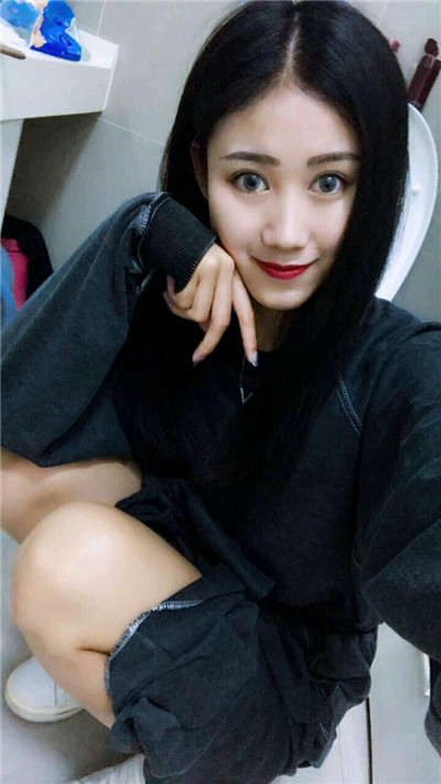 无锡丽都皮先荣切开双眼皮怎么样?价格案例分享