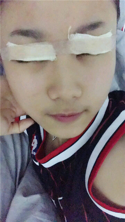无锡丽都皮先荣切开双眼皮怎么样?价格案例分享