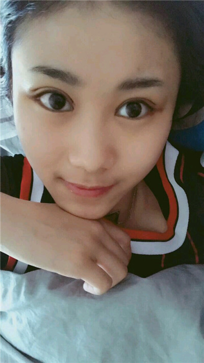 无锡丽都皮先荣切开双眼皮怎么样?价格案例分享
