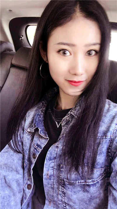 无锡丽都皮先荣切开双眼皮怎么样?价格案例分享