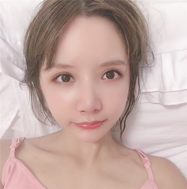 绮林整形外科李承龙颧骨颧弓整形怎么样?价格