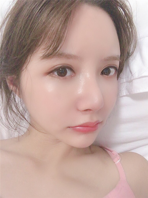 绮林整形外科李承龙颧骨颧弓整形怎么样?价格
