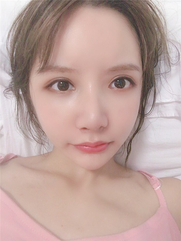 绮林整形外科李承龙颧骨颧弓整形怎么样?价格