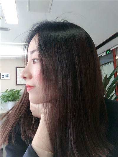 成都艺星黄文肋软骨隆鼻怎么样?价格案例分享