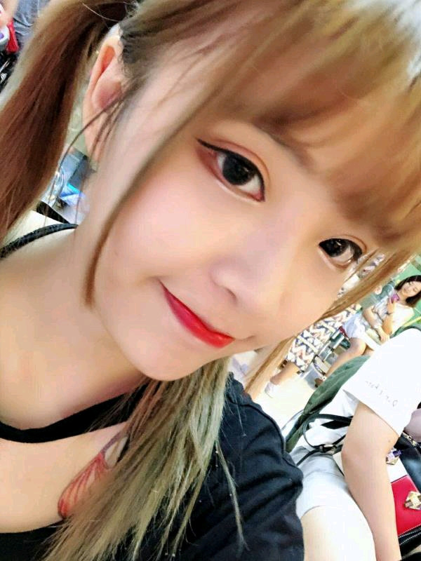 合肥壹加壹医院孟松眼部手术怎么样?价格案例