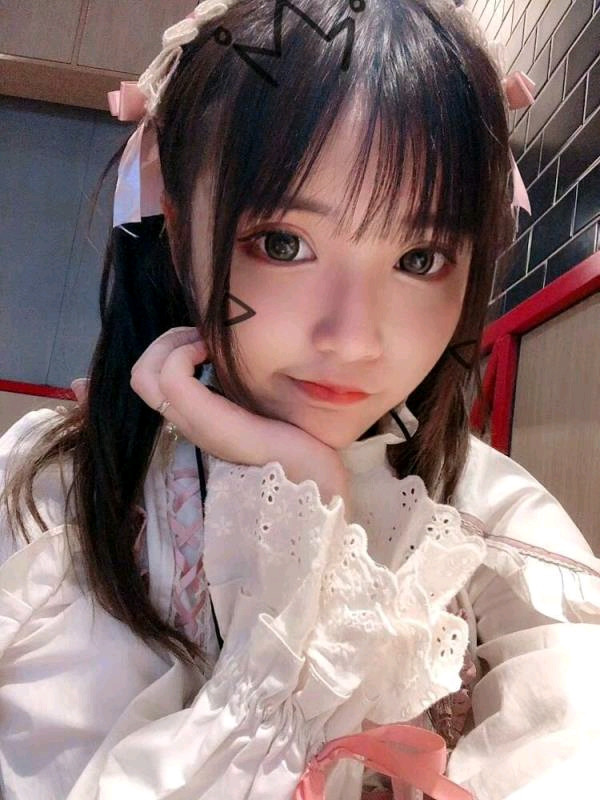 合肥壹加壹医院孟松眼部手术怎么样?价格案例