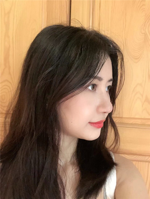 成都心悦容医疗美容杨硕鼻部手术怎么样?价格案