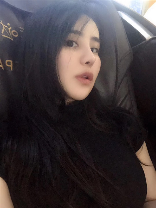 上海李斌医美下眼下至怎么样?价格案例