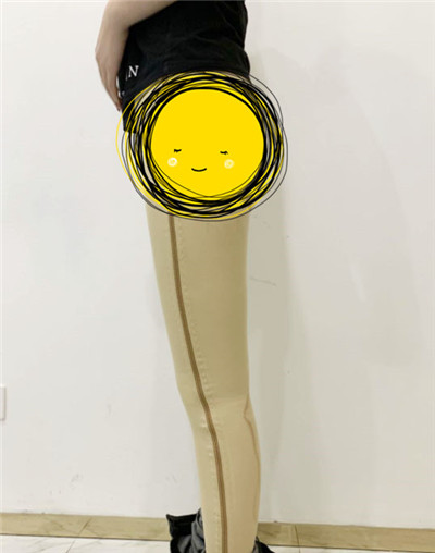 杭州港丽曹飞超吸脂瘦腹部怎么样?价格案例分享