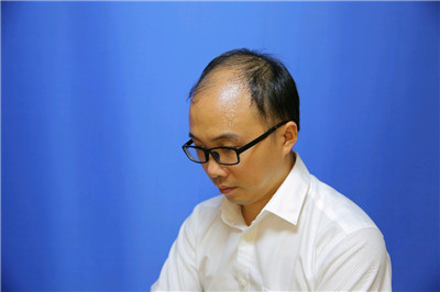 南宁贞韩尹炜能种植发际线怎么样?价格案例分享
