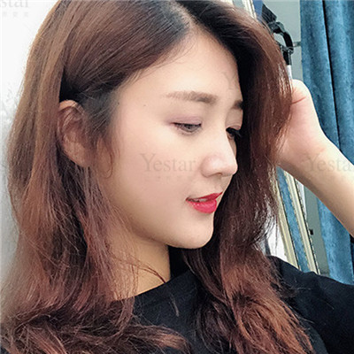 济南艺星杨季涛鼻部手术怎么样?价格案例分享