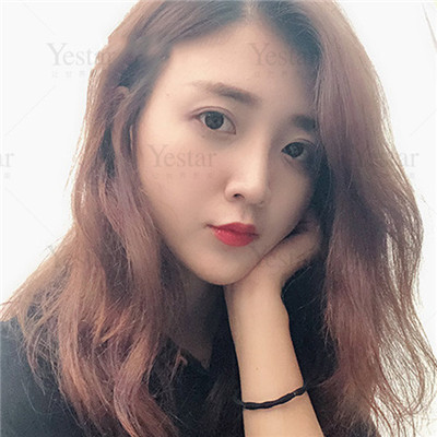 济南艺星杨季涛鼻部手术怎么样?价格案例分享