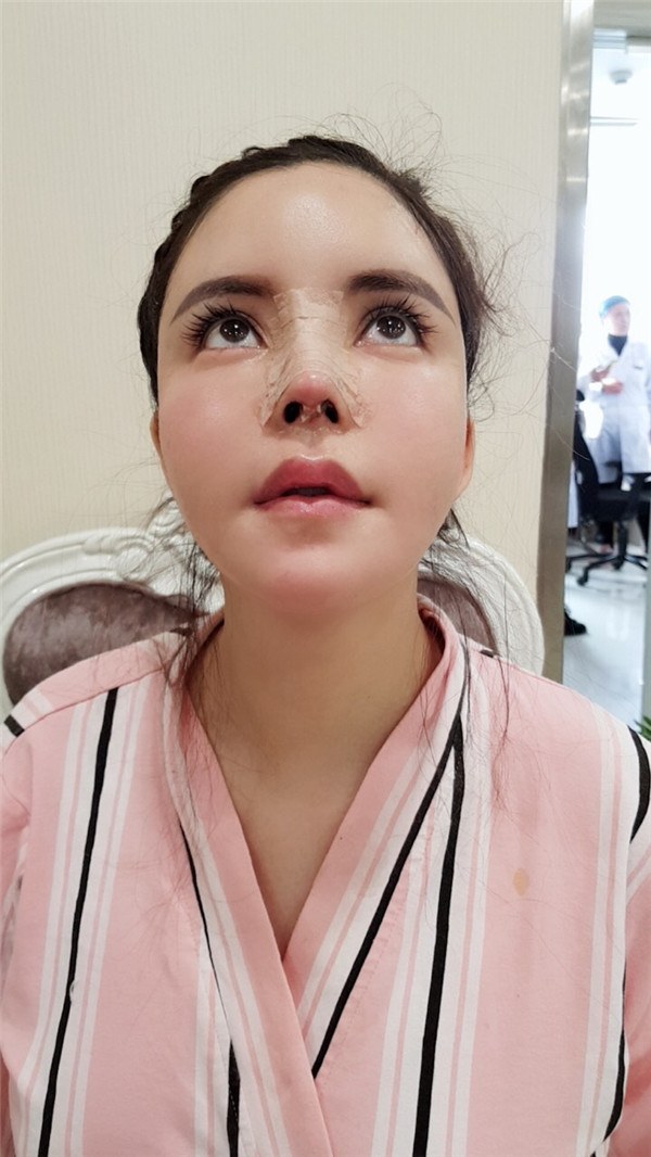 上海喜美王会勇鼻修复怎么样?价格案例