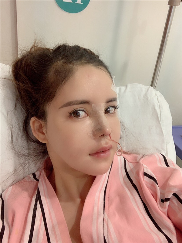 上海喜美王会勇鼻修复怎么样?价格案例