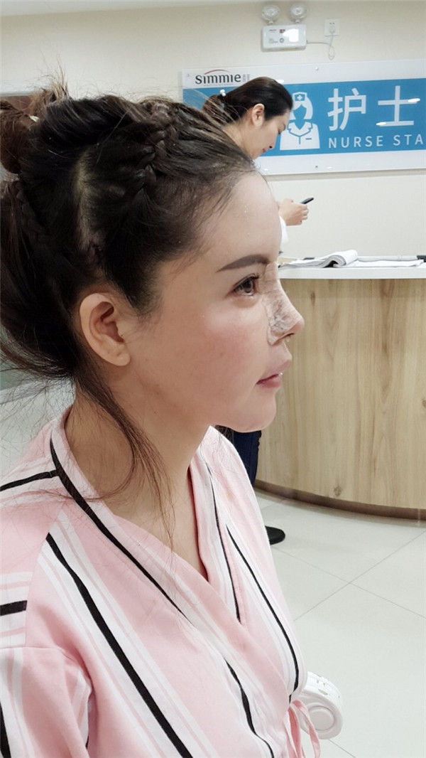 上海喜美王会勇鼻修复怎么样?价格案例