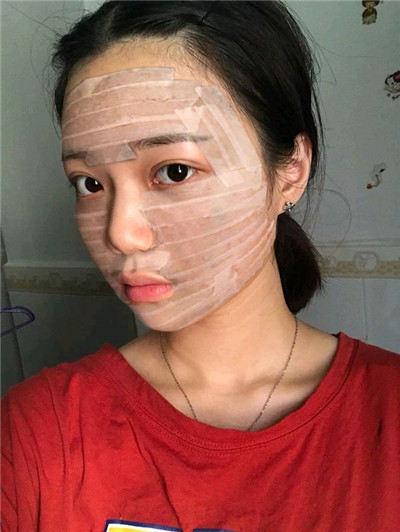 济南星光姜冬宁自体脂肪填充怎么样?价格案例分享